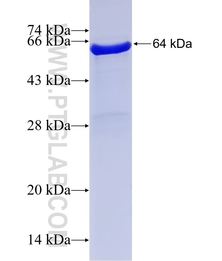 YTHDF1 fusion protein Ag11509 SDS-PAGE