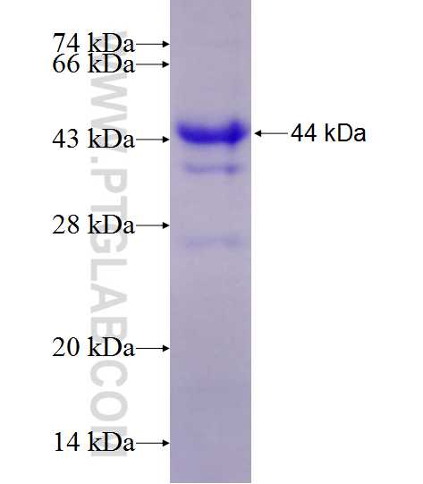 YTHDF1 fusion protein Ag11633 SDS-PAGE