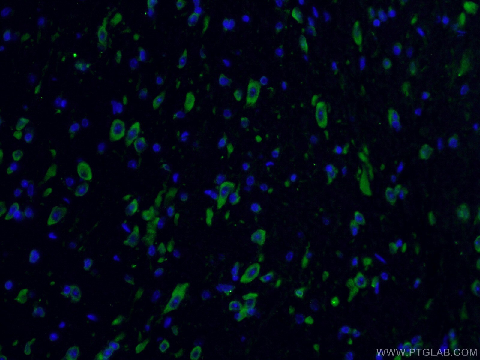 Immunofluorescence (IF) / fluorescent staining of mouse brain tissue using YTHDF2 Polyclonal antibody (24744-1-AP)