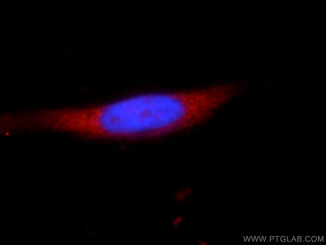 Immunofluorescence (IF) / fluorescent staining of HeLa cells using YTHDF2 Polyclonal antibody (24744-1-AP)