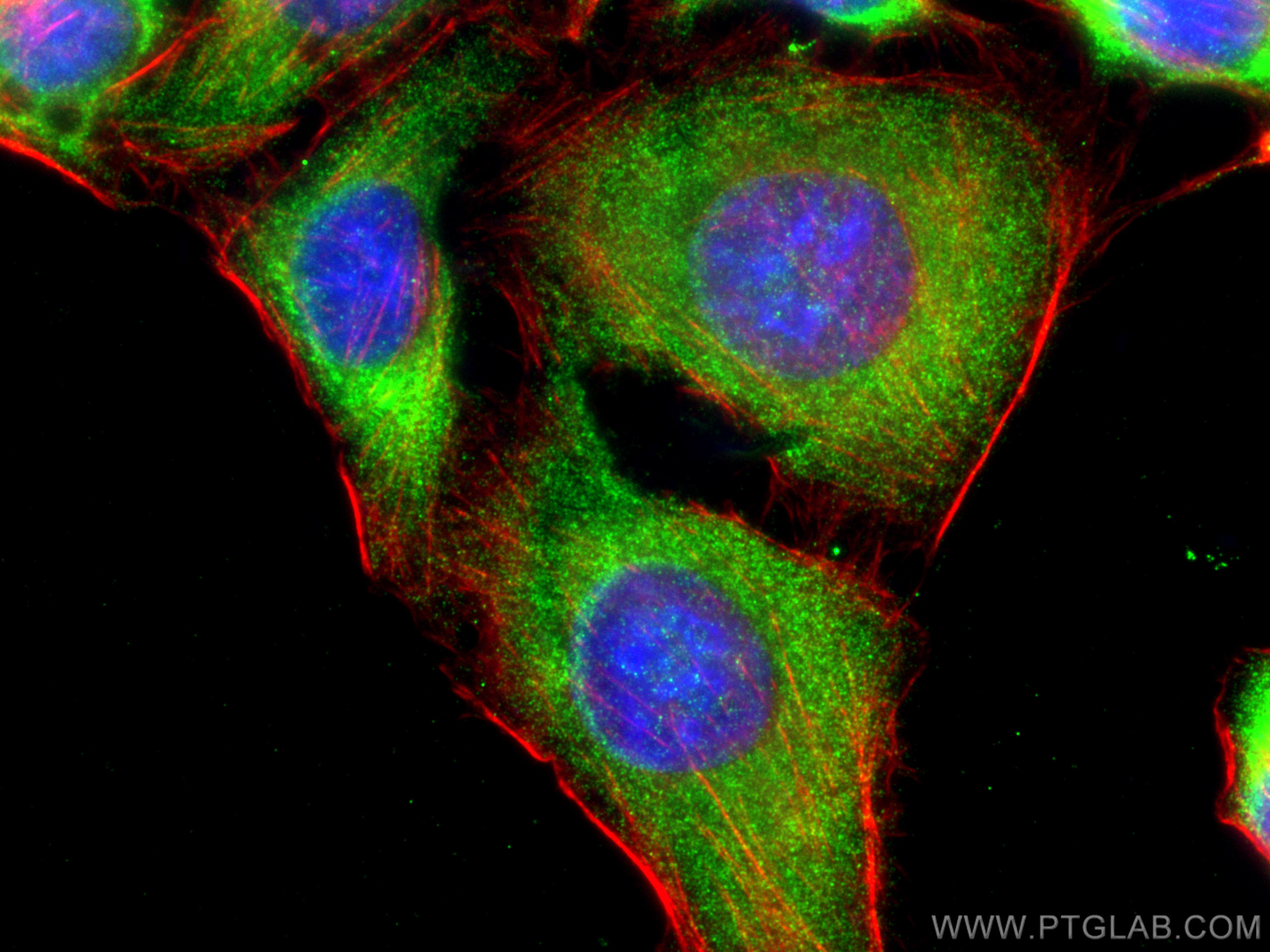 Immunofluorescence (IF) / fluorescent staining of U2OS cells using YTHDF2 Polyclonal antibody (24744-1-AP)