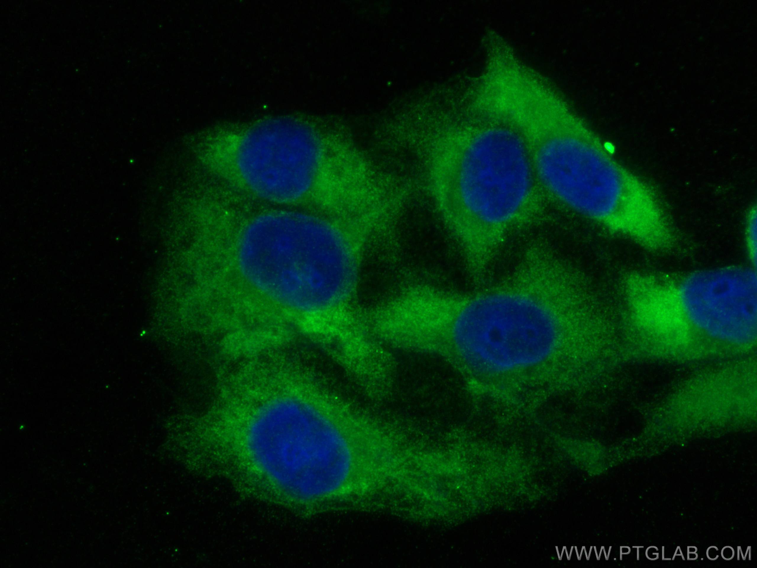 Immunofluorescence (IF) / fluorescent staining of U2OS cells using YTHDF2 Polyclonal antibody (24744-1-AP)