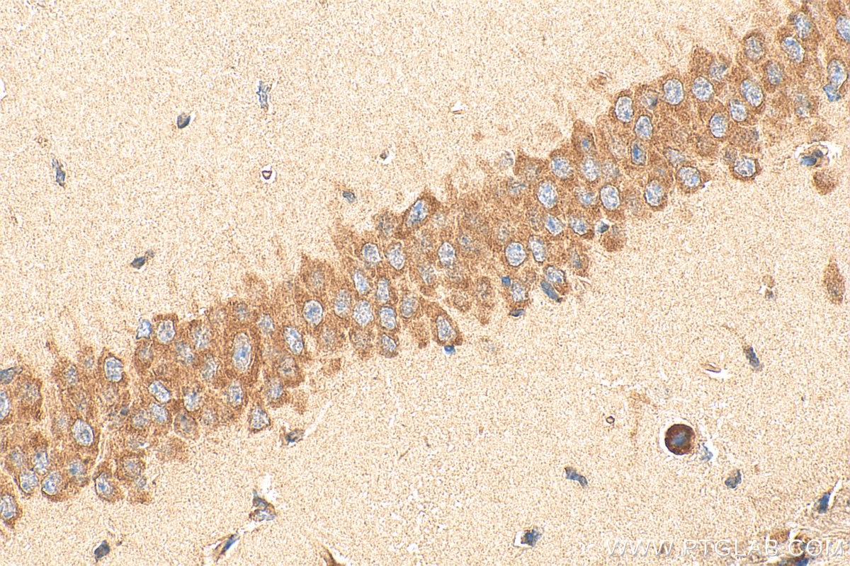 Immunohistochemistry (IHC) staining of mouse brain tissue using YTHDF2 Polyclonal antibody (24744-1-AP)