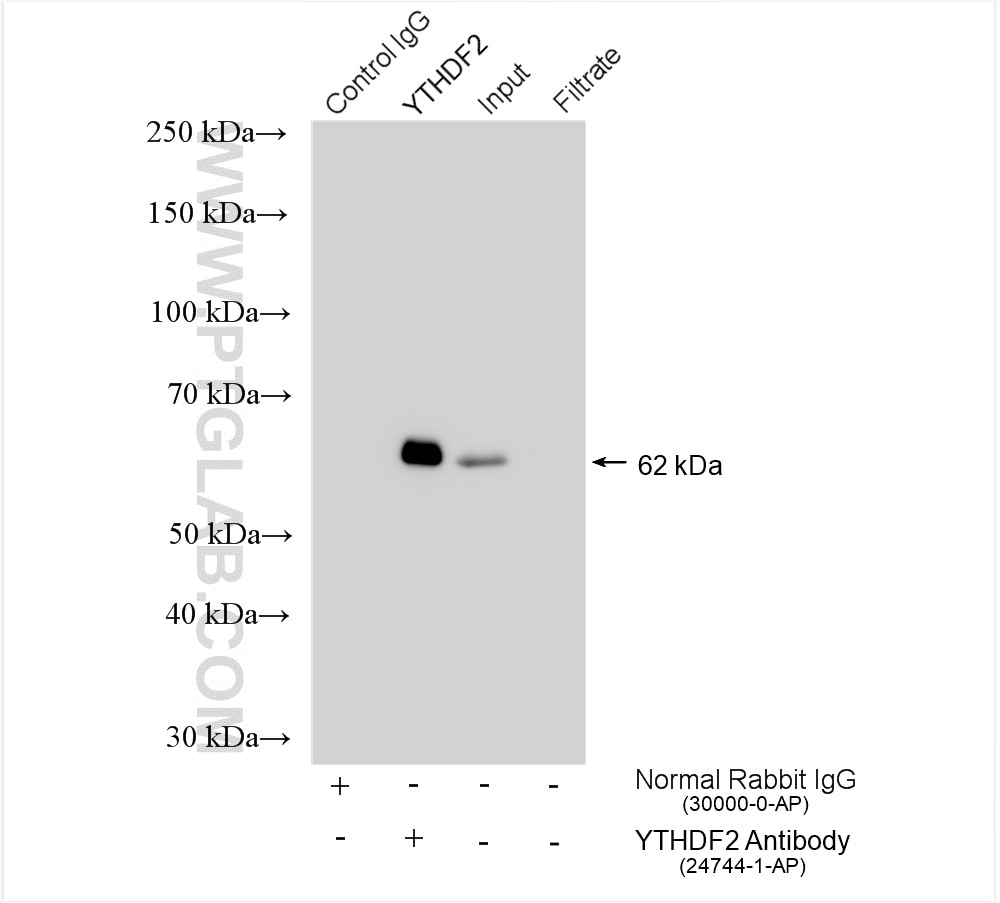Immunoprecipitation (IP) experiment of HeLa cells using YTHDF2 Polyclonal antibody (24744-1-AP)