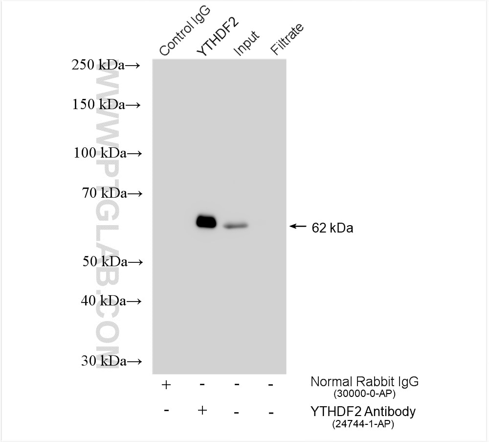 IP experiment of HeLa using 24744-1-AP