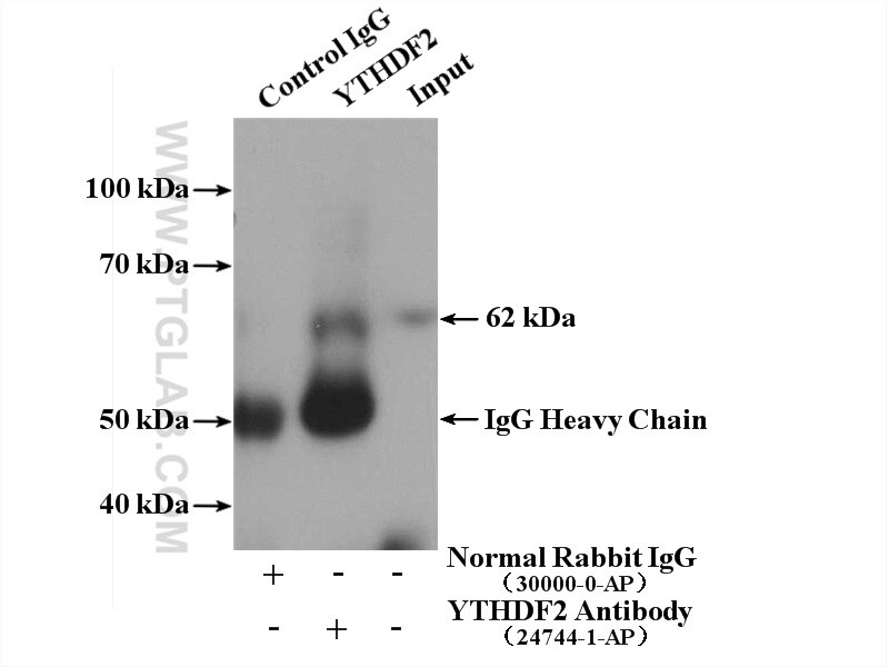 Immunoprecipitation (IP) experiment of Jurkat cells using YTHDF2 Polyclonal antibody (24744-1-AP)