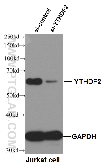 Western Blot (WB) analysis of Jurkat cells using YTHDF2 Polyclonal antibody (24744-1-AP)