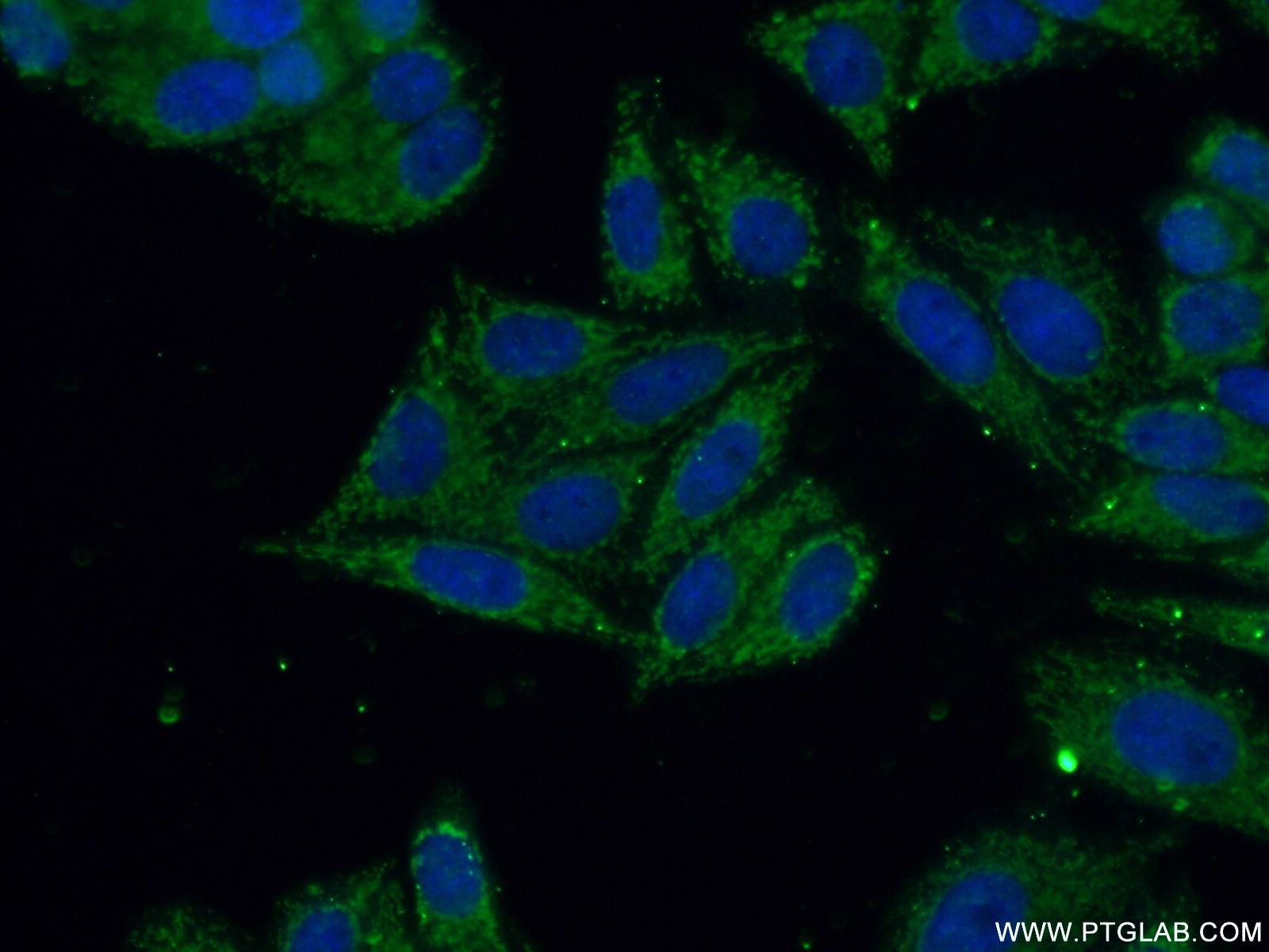 Immunofluorescence (IF) / fluorescent staining of HepG2 cells using YTHDF2 Polyclonal antibody (26771-1-AP)