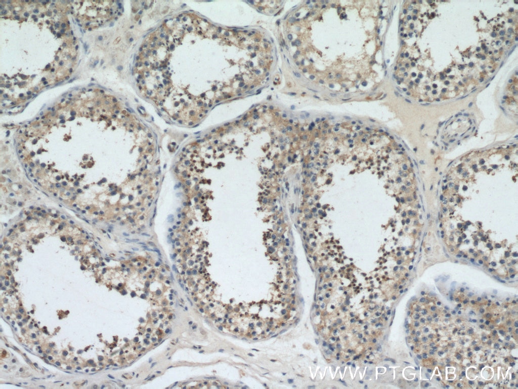 Immunohistochemistry (IHC) staining of human testis tissue using YTHDF2 Polyclonal antibody (26771-1-AP)