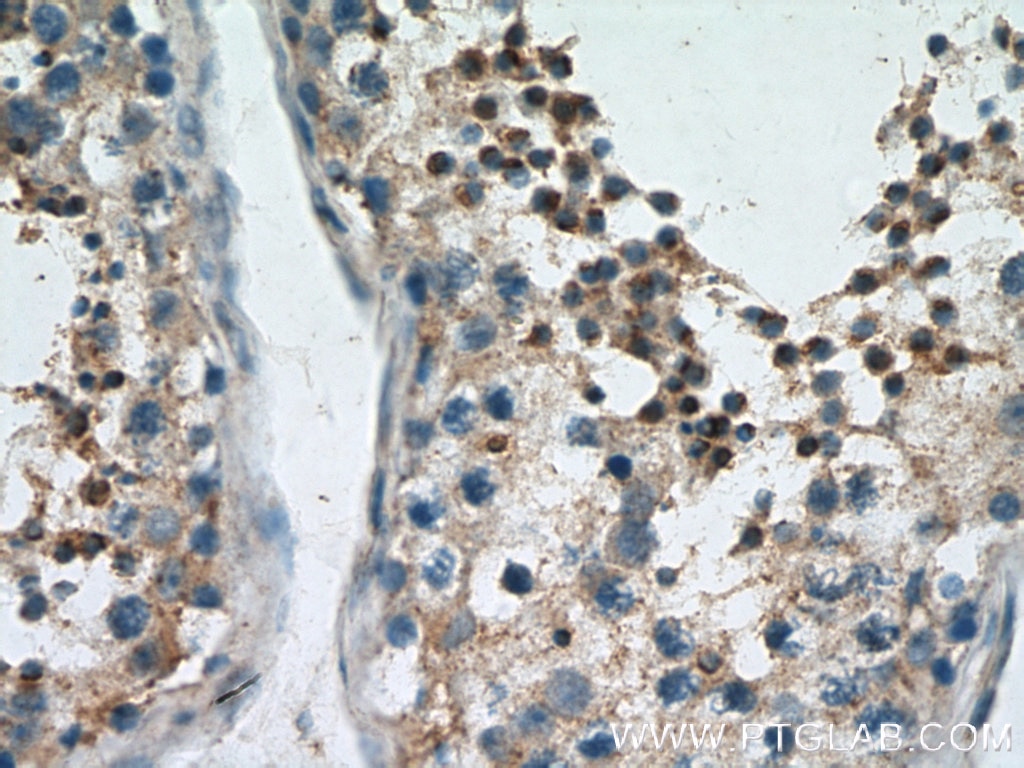 Immunohistochemistry (IHC) staining of human testis tissue using YTHDF2 Polyclonal antibody (26771-1-AP)