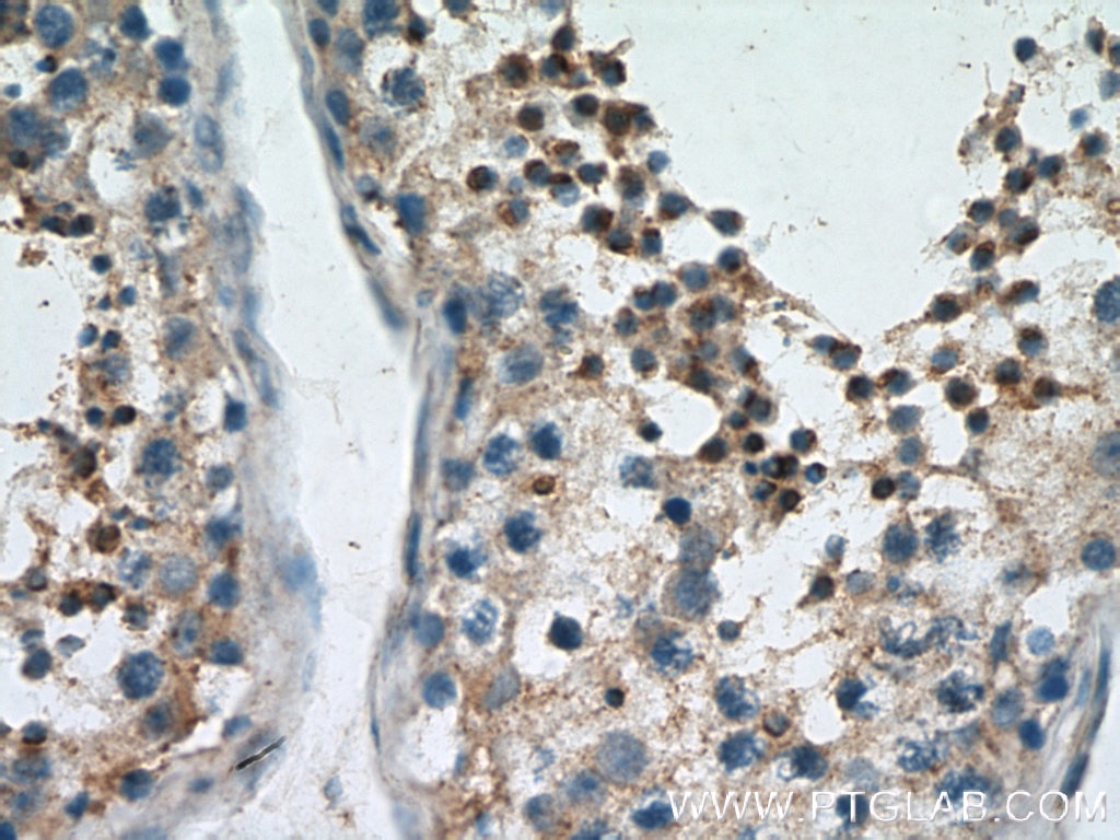 IHC staining of human testis using 26771-1-AP