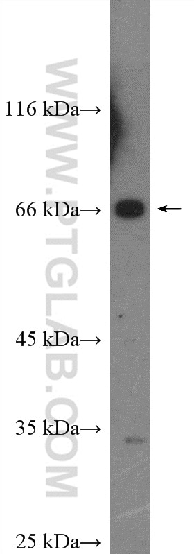 Western Blot (WB) analysis of Raji cells using YTHDF2 Polyclonal antibody (26771-1-AP)