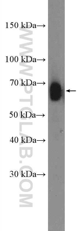 Western Blot (WB) analysis of Raji cells using YTHDF2 Polyclonal antibody (26771-1-AP)