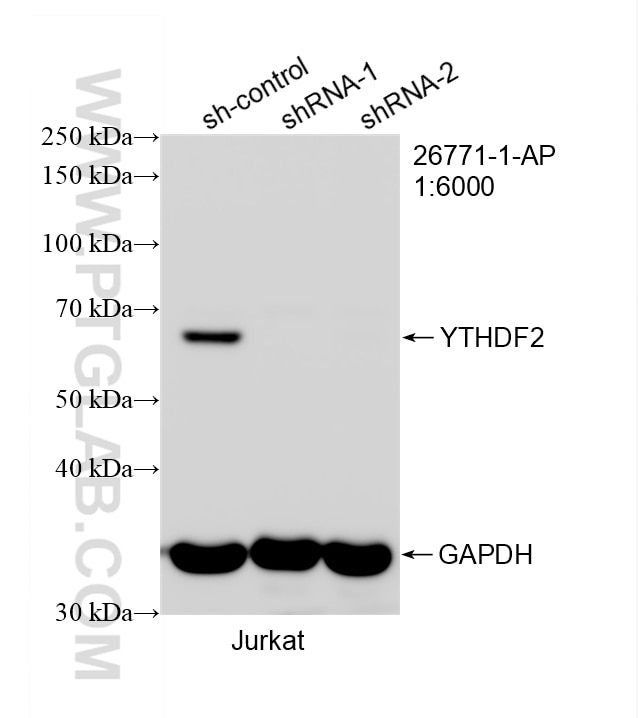 Western Blot (WB) analysis of Jurkat cells using YTHDF2 Polyclonal antibody (26771-1-AP)