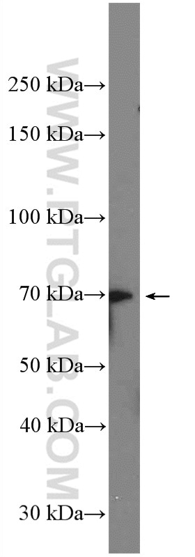 Western Blot (WB) analysis of mouse brain tissue using YTHDF2 Polyclonal antibody (26771-1-AP)
