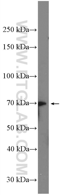 Western Blot (WB) analysis of mouse brain tissue using YTHDF2 Polyclonal antibody (26771-1-AP)