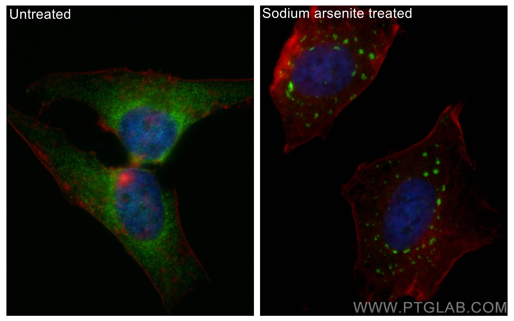Immunofluorescence (IF) / fluorescent staining of HeLa cells using YTHDF2 Recombinant antibody (81340-1-RR)