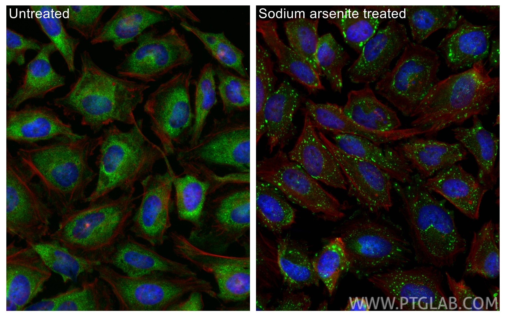 Immunofluorescence (IF) / fluorescent staining of HeLa cells using YTHDF2 Recombinant monoclonal antibody (81340-1-RR)