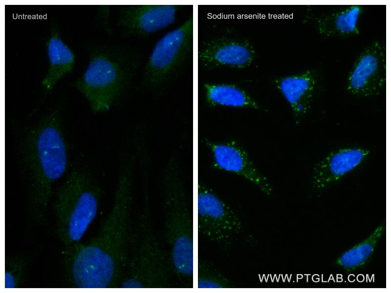 Immunofluorescence (IF) / fluorescent staining of HeLa cells using CoraLite® Plus 488-conjugated YTHDF2 Recombinant a (CL488-81340)