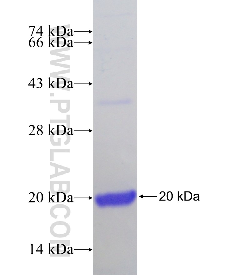 YTHDF2 fusion protein Ag25348 SDS-PAGE