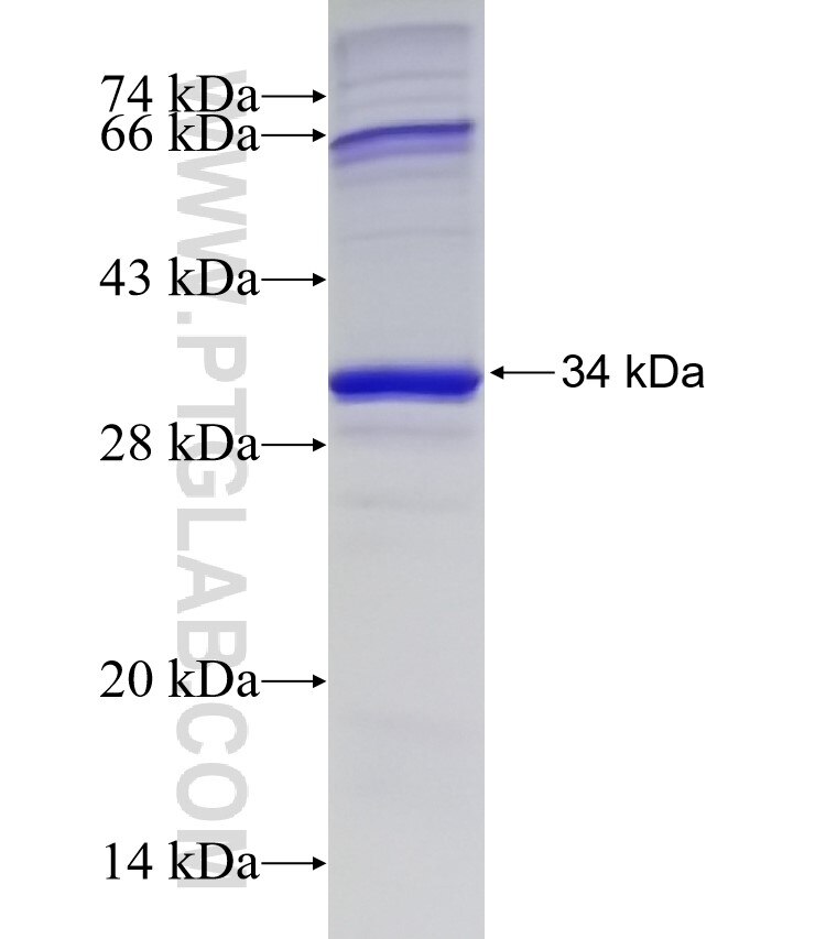 YTHDF2 fusion protein Ag5922 SDS-PAGE