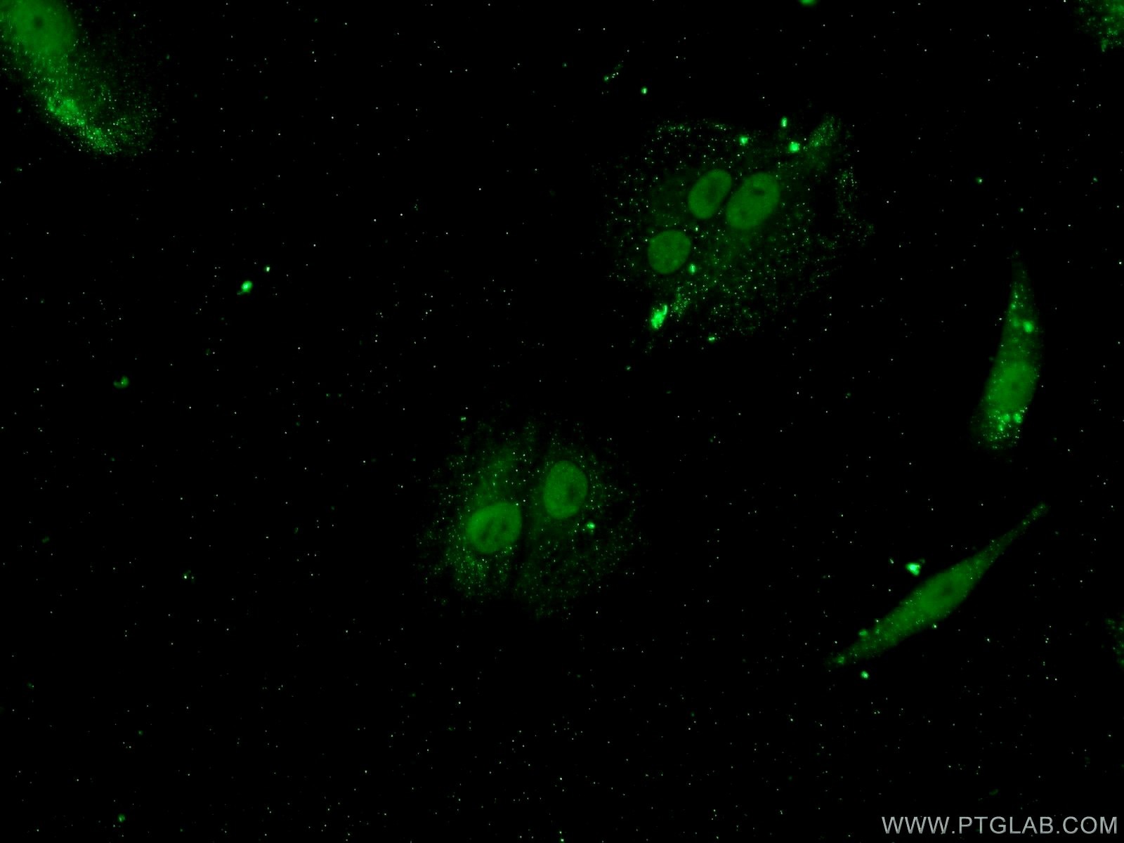 Immunofluorescence (IF) / fluorescent staining of A549 cells using YTHDF3-specific Polyclonal antibody (25537-1-AP)
