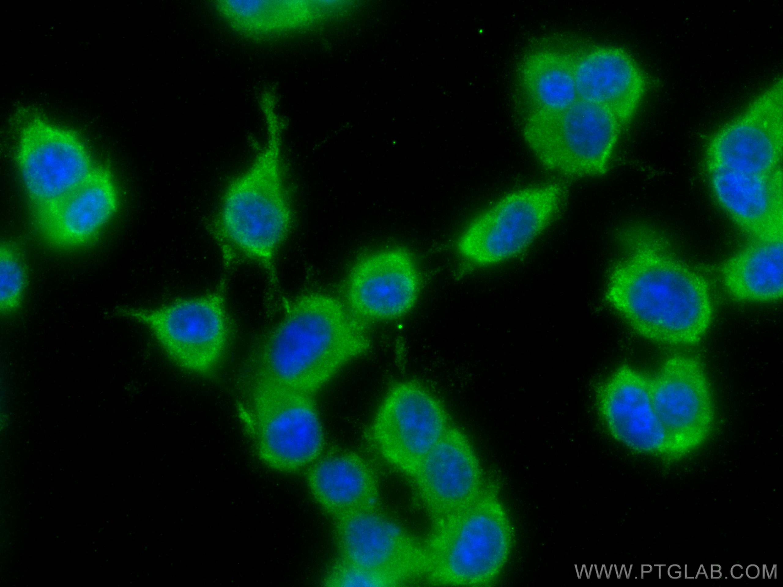 Immunofluorescence (IF) / fluorescent staining of PC-12 cells using YTHDF3-specific Polyclonal antibody (25537-1-AP)