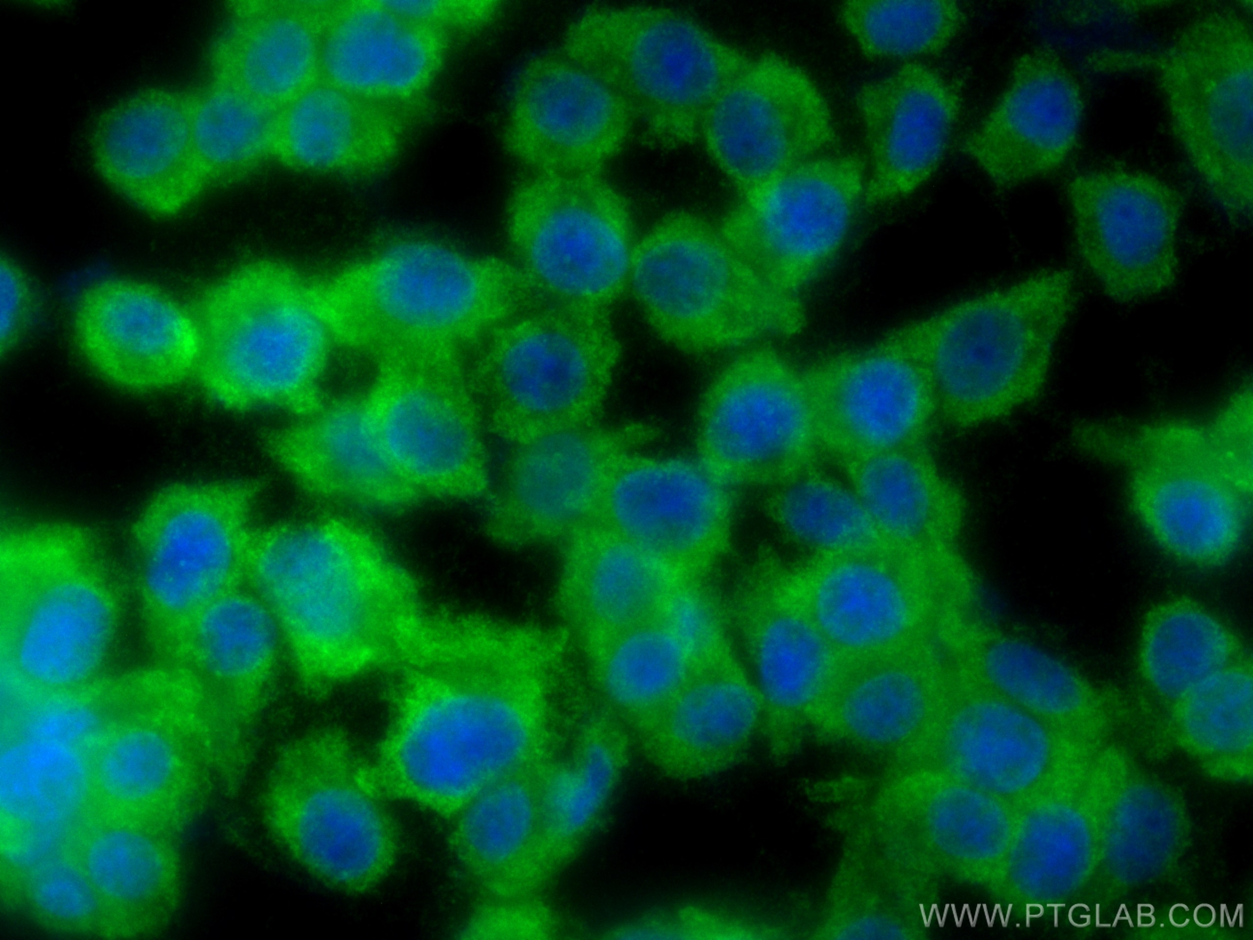 Immunofluorescence (IF) / fluorescent staining of PC-12 cells using YTHDF3-specific Polyclonal antibody (25537-1-AP)