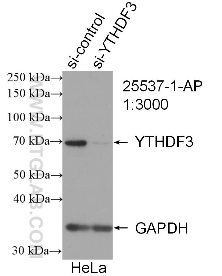Western Blot (WB) analysis of HeLa cells using YTHDF3-specific Polyclonal antibody (25537-1-AP)