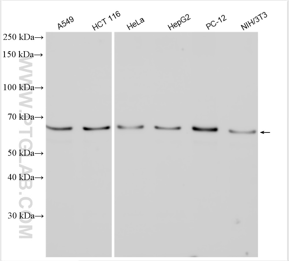 Western Blot (WB) analysis of various lysates using YTHDF3-specific Polyclonal antibody (25537-1-AP)