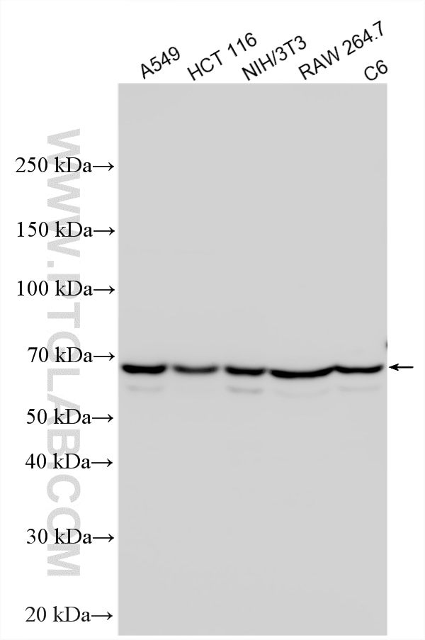 Western Blot (WB) analysis of various lysates using YTHDF3-specific Polyclonal antibody (25537-1-AP)