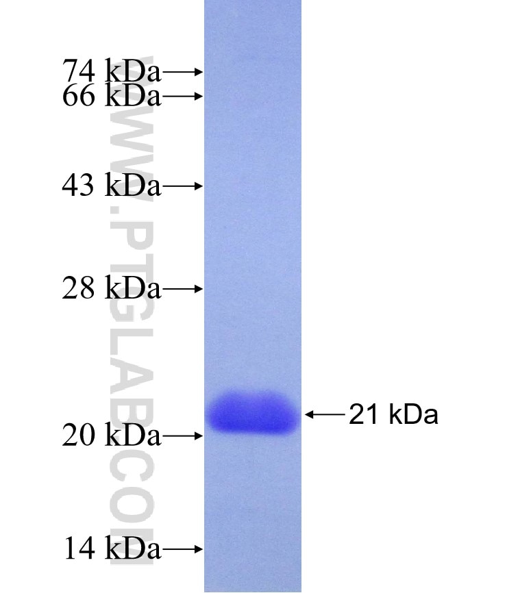 YTHDF3 fusion protein Ag22374 SDS-PAGE