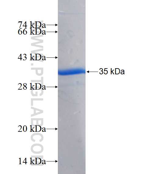 YTHDF3 fusion protein Ag22407 SDS-PAGE