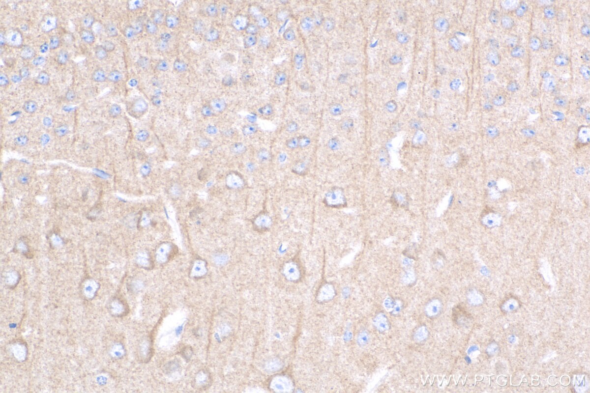Immunohistochemistry (IHC) staining of mouse brain tissue using YWHAH Polyclonal antibody (15222-1-AP)