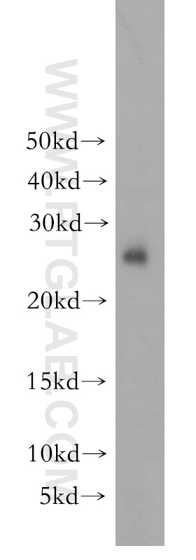 Western Blot (WB) analysis of human brain tissue using YWHAH Polyclonal antibody (15222-1-AP)