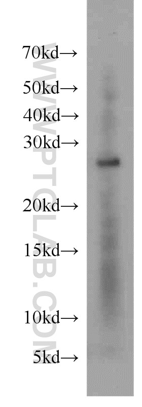 Western Blot (WB) analysis of mouse brain tissue using YWHAH Polyclonal antibody (15222-1-AP)