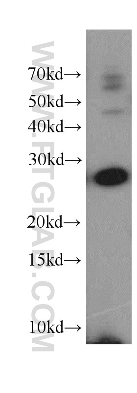 Western Blot (WB) analysis of A431 cells using YWHAH Polyclonal antibody (15222-1-AP)