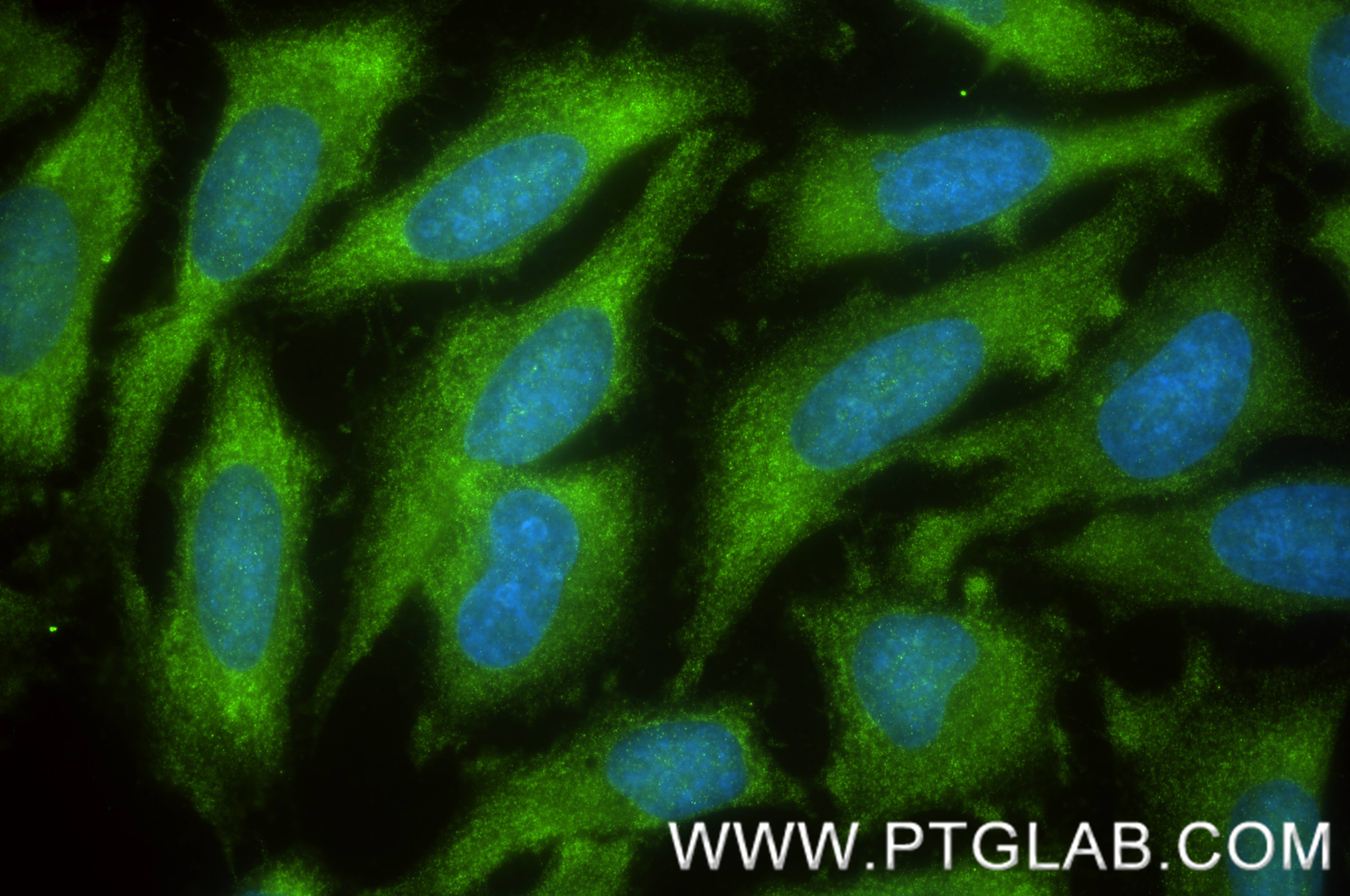 Immunofluorescence (IF) / fluorescent staining of HeLa cells using YWHAH Recombinant monoclonal antibody (85987-1-RR)