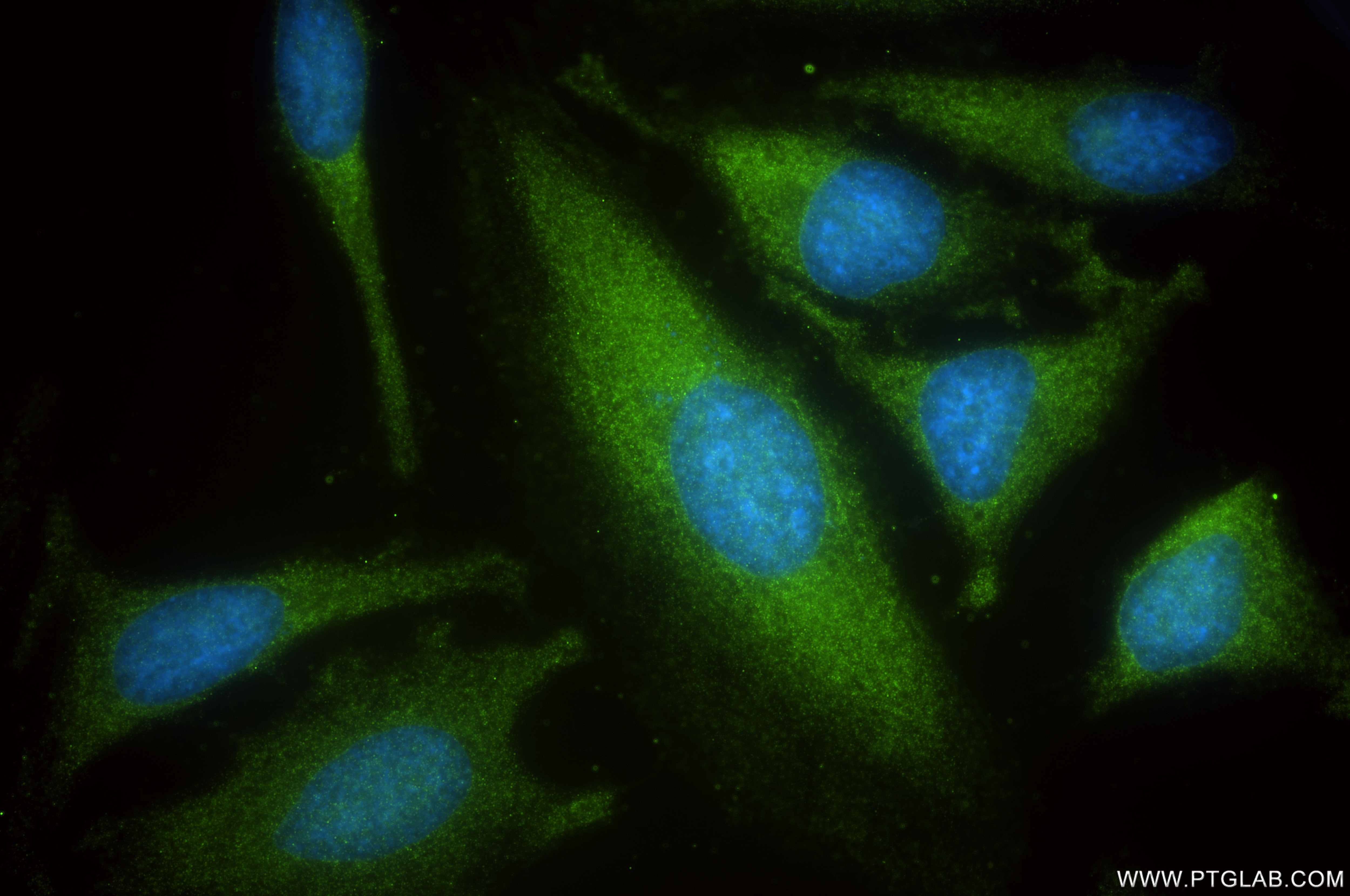 Immunofluorescence (IF) / fluorescent staining of HeLa cells using YWHAH Recombinant antibody (85987-2-RR)
