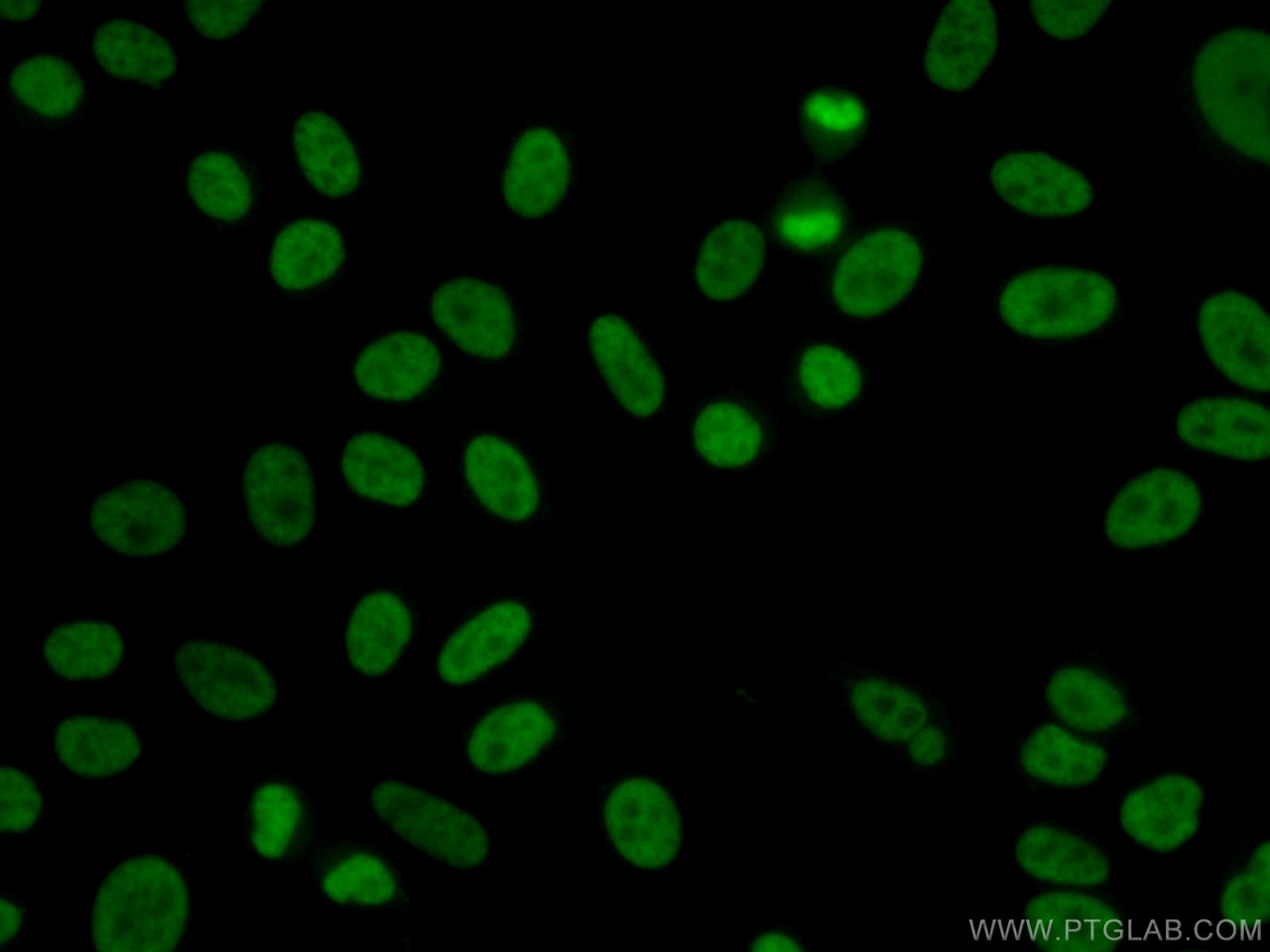 Immunofluorescence (IF) / fluorescent staining of HepG2 cells using YY1 Polyclonal antibody (22156-1-AP)