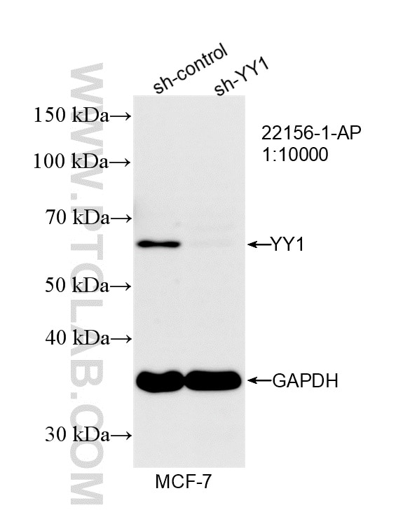 WB result of YY1 antibody (22156-1-AP; 1:10000; incubated at room temperature for 1.5 hours) with sh-Control and sh-YY1 transfected MCF-7 cells. Western Blot (WB) analysis of MCF-7 cells using YY1 Polyclonal antibody (22156-1-AP)