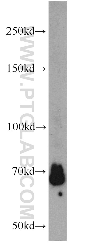 Western Blot (WB) analysis of HeLa cells using YY1 Polyclonal antibody (22156-1-AP)