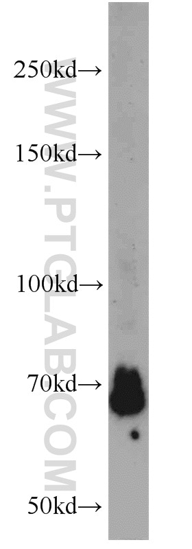 WB analysis of HeLa using 22156-1-AP