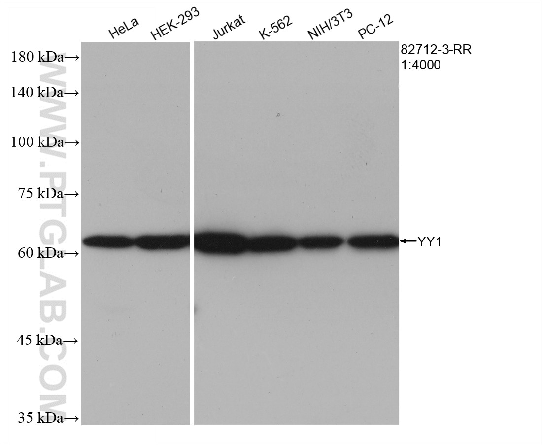 Western Blot (WB) analysis of various lysates using YY1 Recombinant antibody (82712-3-RR)