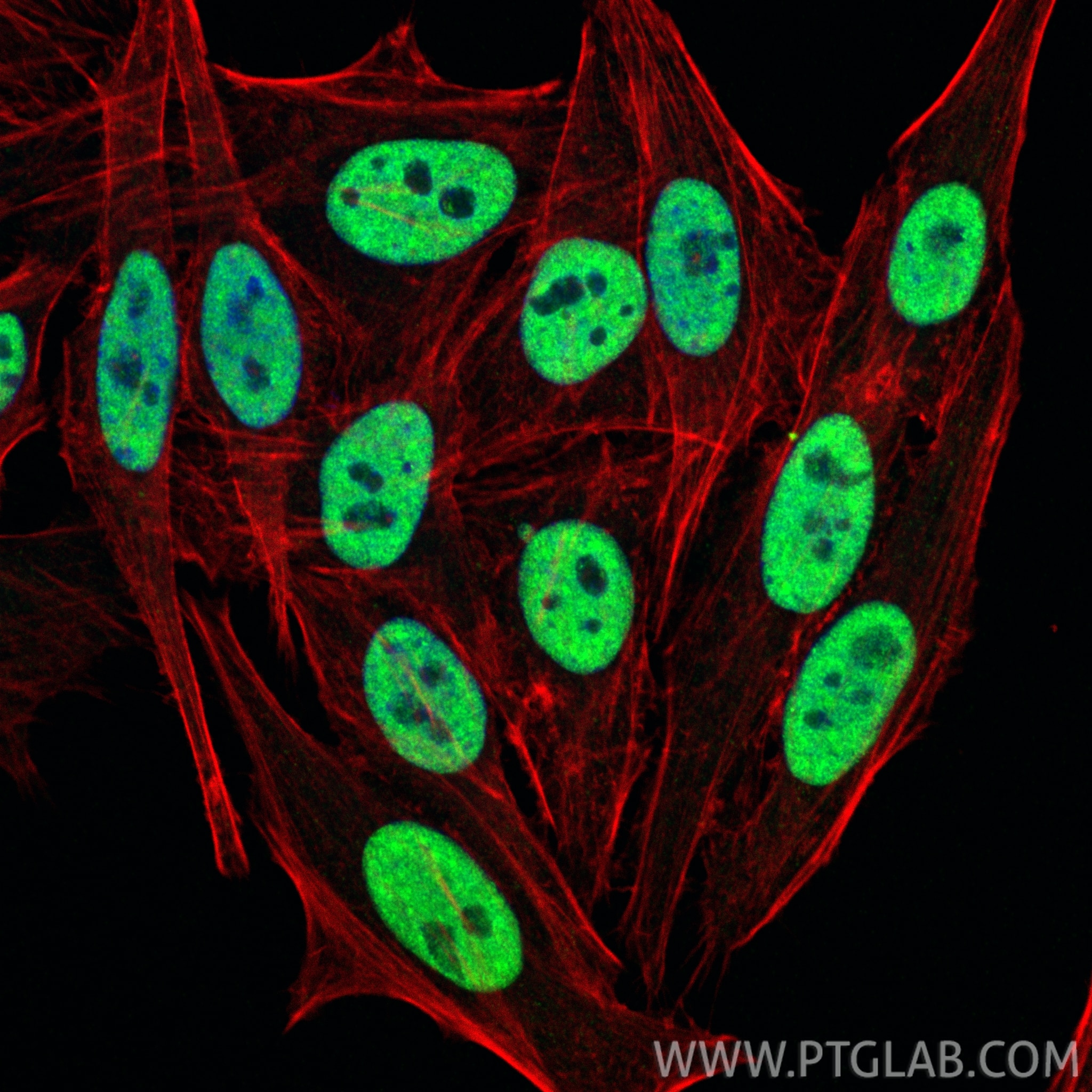 IF Staining of HepG2 using 82712-5-RR Immunofluorescence (IF) / fluorescent staining of HepG2 cells using YY1 Recombinant monoclonal antibody (82712-5-RR)