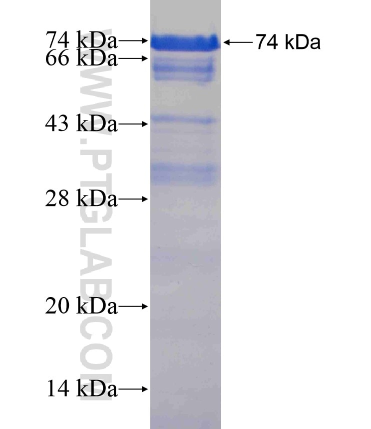 YY1 fusion protein Ag17792 SDS-PAGE