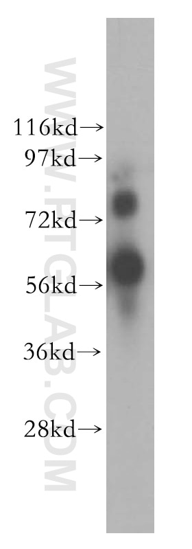 Western Blot (WB) analysis of MDA-MB-231 cells using YY1AP1 Polyclonal antibody (10425-1-AP)