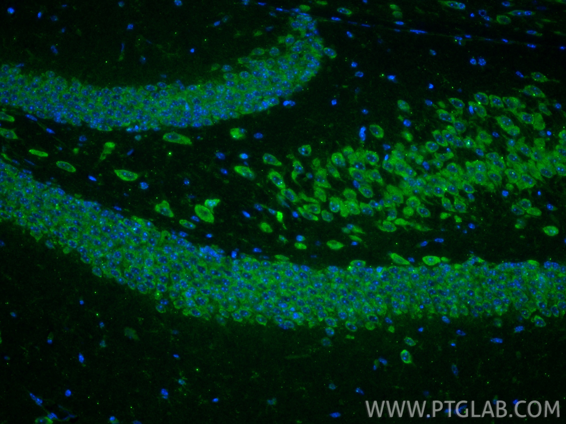 Immunofluorescence (IF) / fluorescent staining of mouse brain tissue using ZADH2 Polyclonal antibody (14679-1-AP)