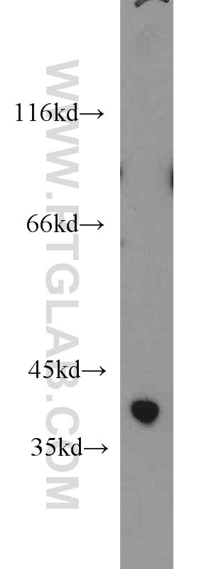 WB analysis of mouse brain using 14679-1-AP