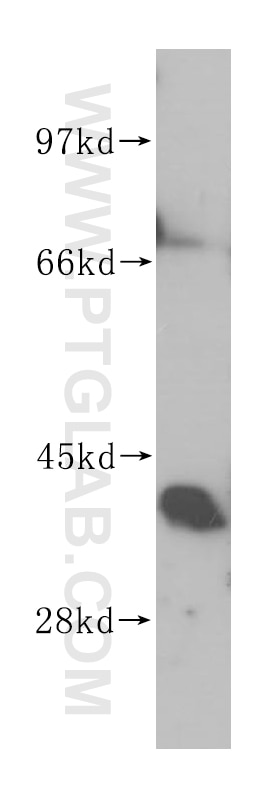Western Blot (WB) analysis of mouse brain tissue using ZADH2 Polyclonal antibody (14679-1-AP)